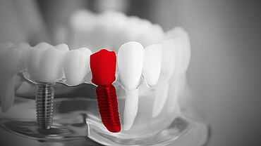 ZwickRoell testsystemen voor de tandheelkundige sector